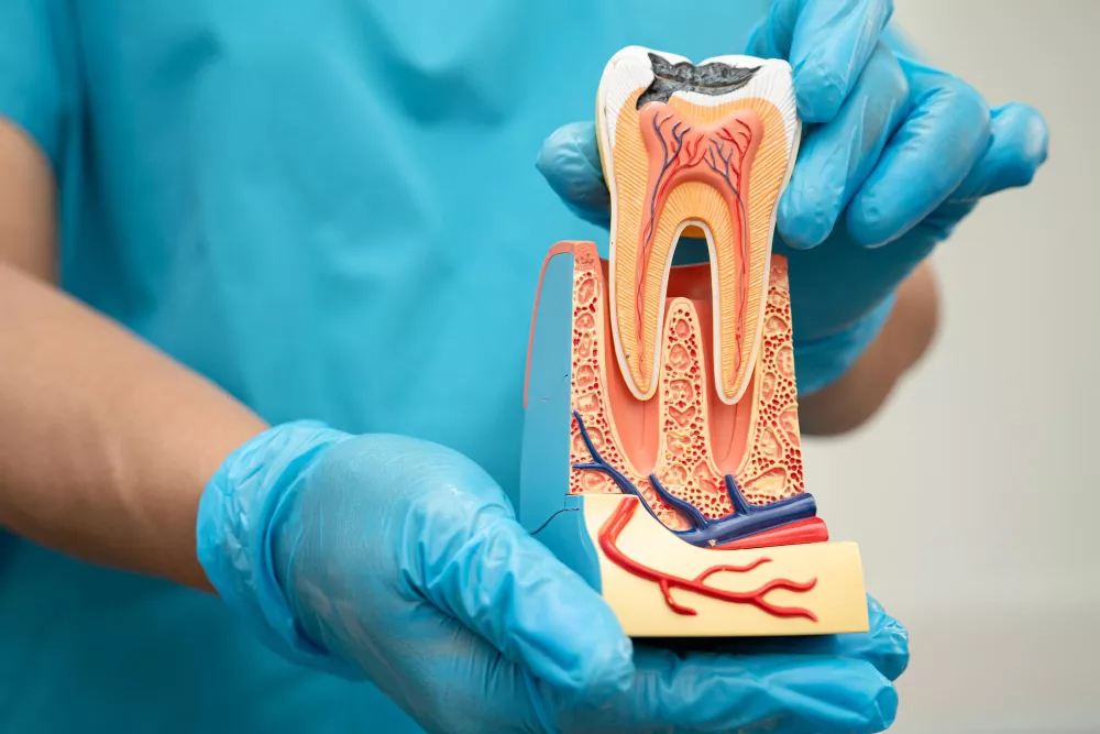 Root Canal Treatment(RCT)