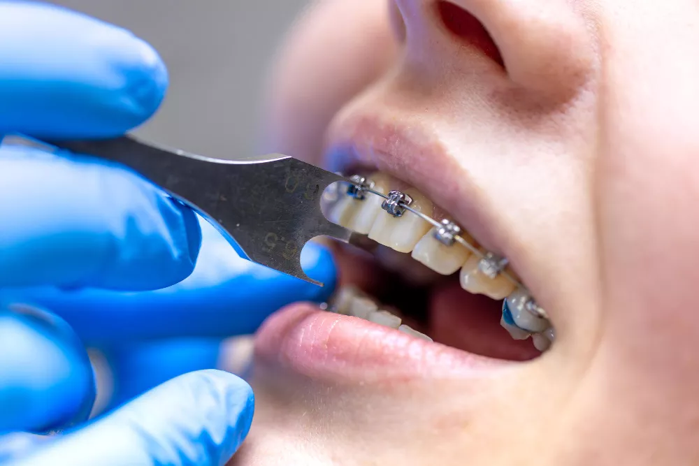 Orthodontics